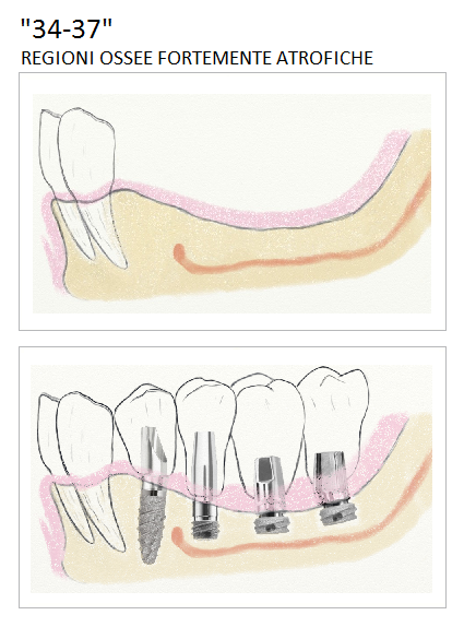 Oralplant_Resolve_4_Home_2.png